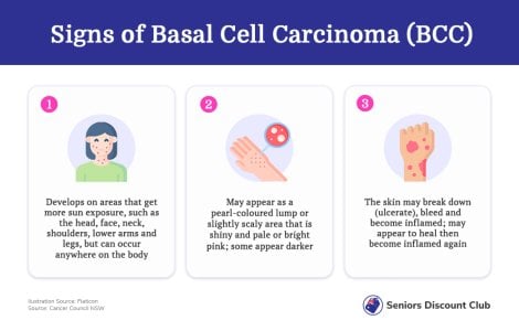 Signs of Basal Cell Carcinoma (BCC).jpg