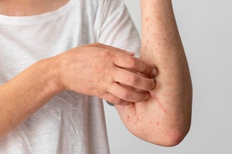 skin-allergy-reaction-person-s-arm.jpg