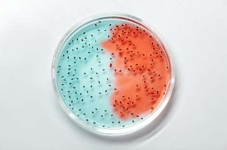 compressed-pexels-bacteria.jpeg