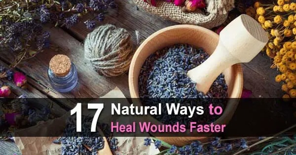 17 Natural Ways to Heal Wounds Faster